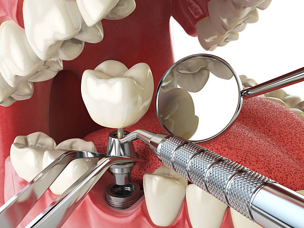 Best Weekend Emergency Dentist in Forestville, CA
